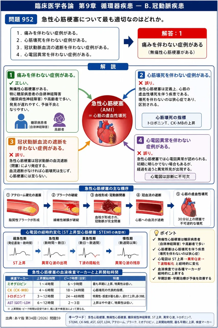 あマ指 第34回(2026) 問題59｜急性心筋梗塞について最も適切なのはどれか。 解説図