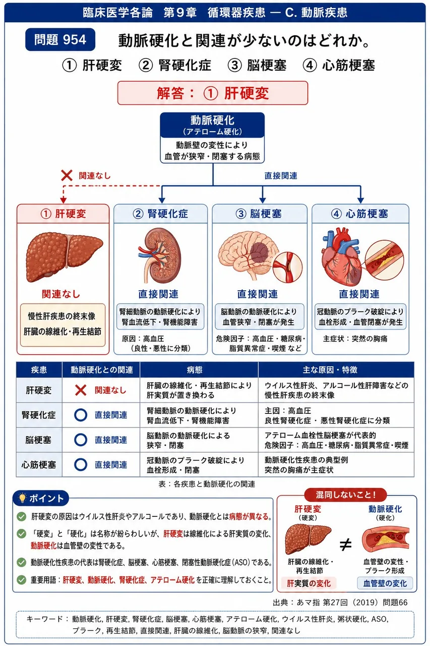 あマ指 第27回(2019) 問題66｜動脈硬化と関連が少ないのはどれか。 解説図