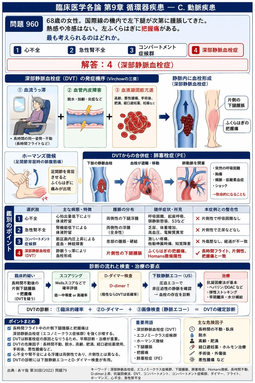 あマ指 第30回(2022) 問題79｜「68歳の女性。国際線の機内で左下腿が次第に腫脹してきた。熱感や冷感はない。 左ふくらはぎに把握痛がある。」最も考えられるのはどれか。 解説図