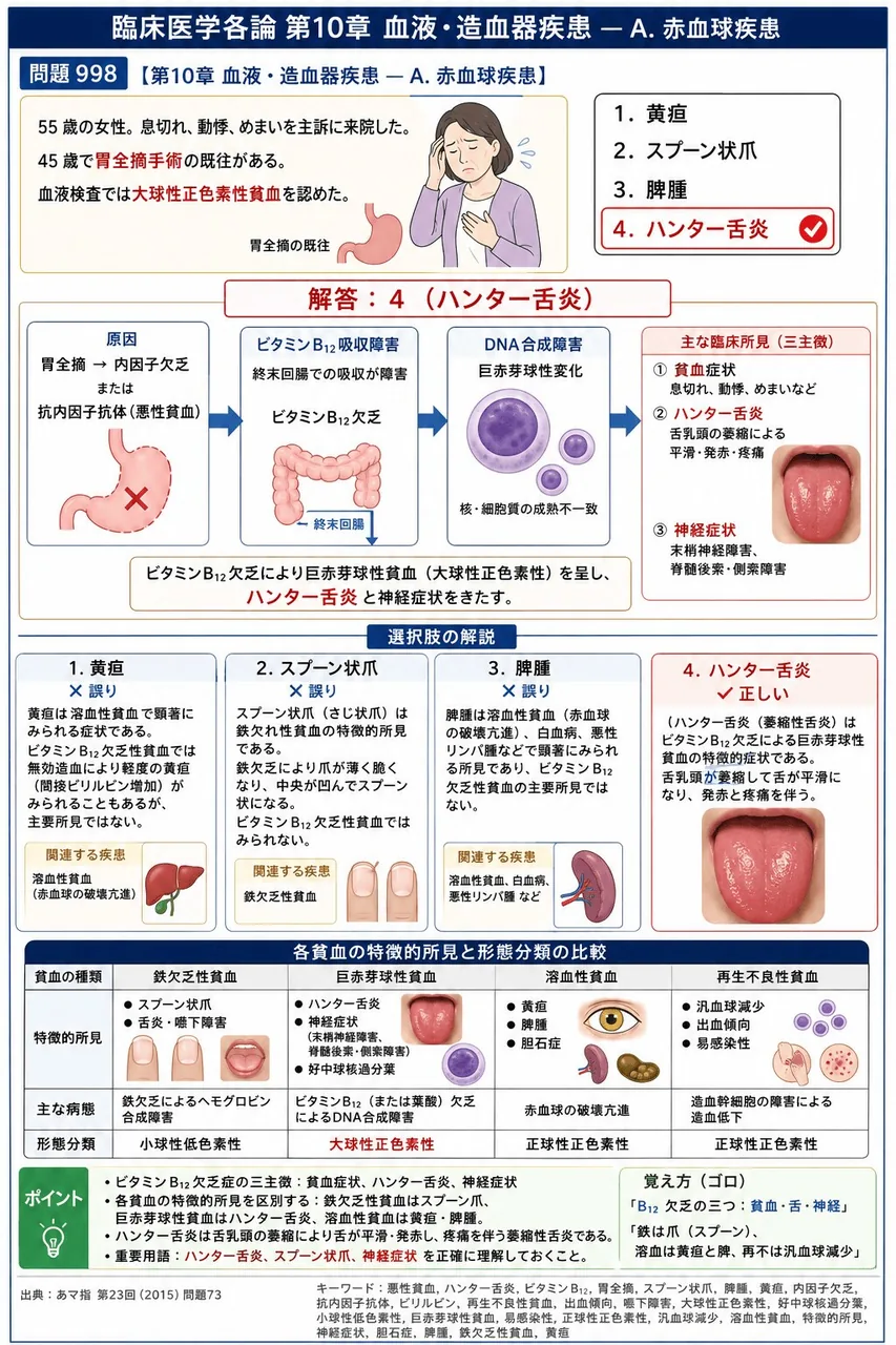 あマ指 第23回(2015) 問題73｜｢55 歳の女性。息切れ、動悸、めまいを主訴に来院した。45 歳で胃全摘手術の既往がある。血液検査では大球性正色素性貧血を認めた｡」本疾患でみられるのはどれか。 解説図