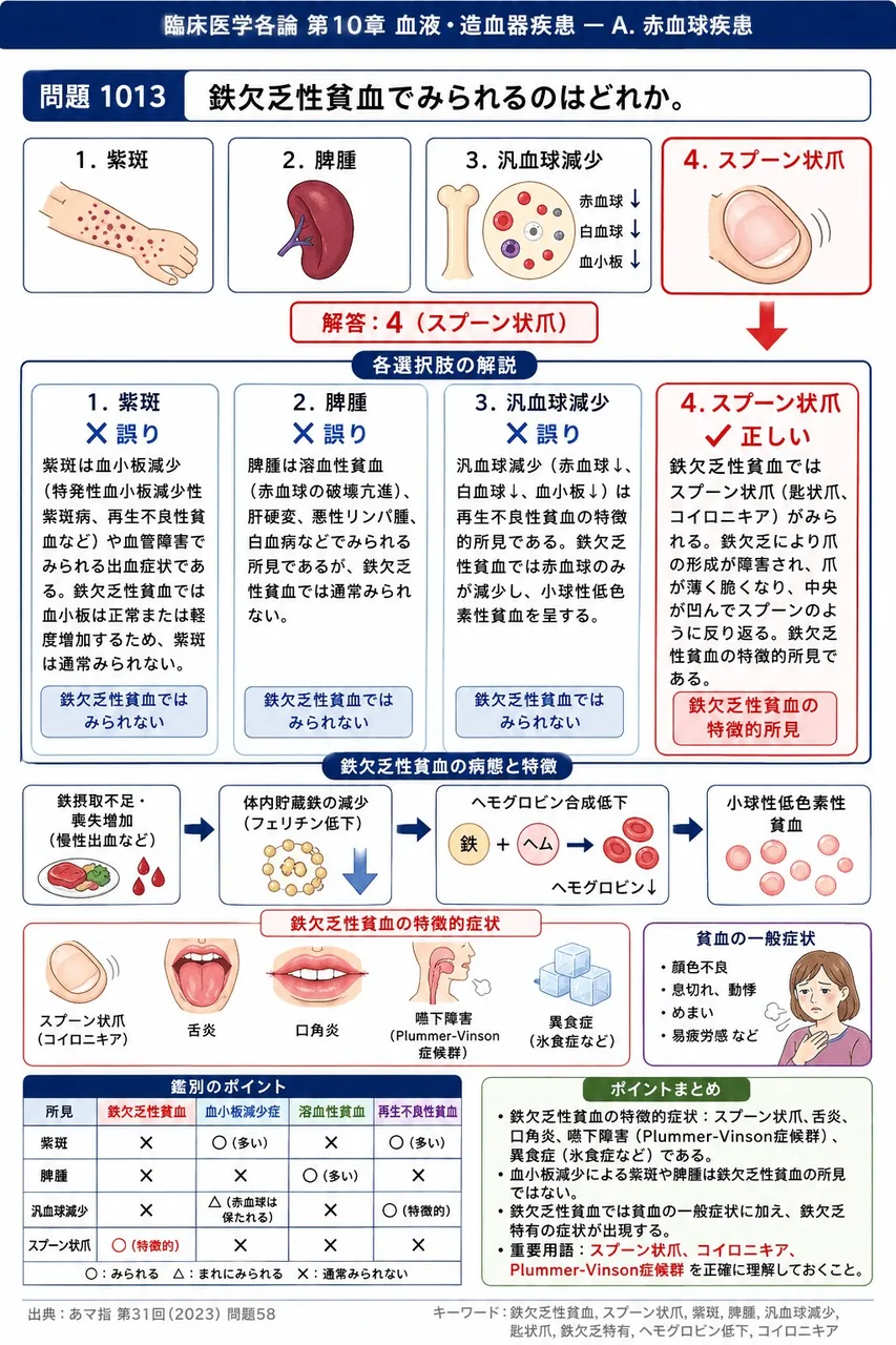 あマ指 第31回(2023) 問題58｜鉄欠乏性貧血でみられるのはどれか。 解説図