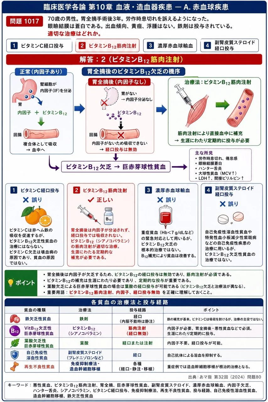 あマ指 第32回(2024) 問題80｜次の文で示す症例について、問いに答えよ。「70歳の男性。胃全摘手術後3年。労作時息切れを訴えるようになった。眼瞼結膜は蒼白である。出血傾向、黄疸、浮腫はない。鉄剤は投与されている。」適切な治療はどれか。 解説図