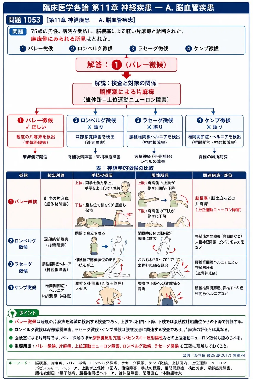 あマ指 第25回(2017) 問題74｜「75歳の男性。病院を受診し、脳梗塞による軽い片麻痺と診断された。」麻痺側にみられる所見はどれか。 解説図