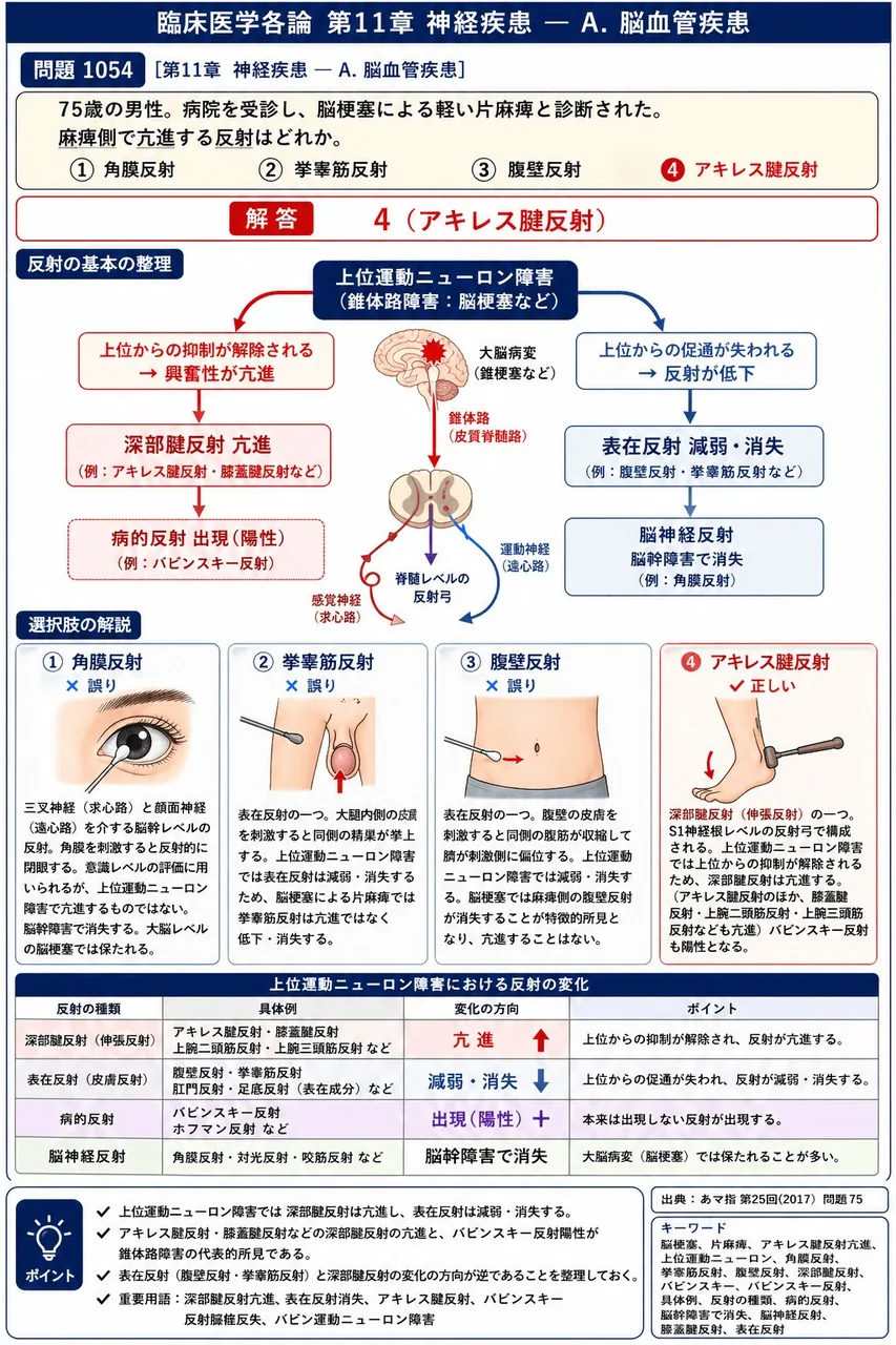 あマ指 第25回(2017) 問題75｜「75歳の男性。病院を受診し、脳梗塞による軽い片麻痺と診断された。」麻痺側で亢進する反射はどれか。 解説図