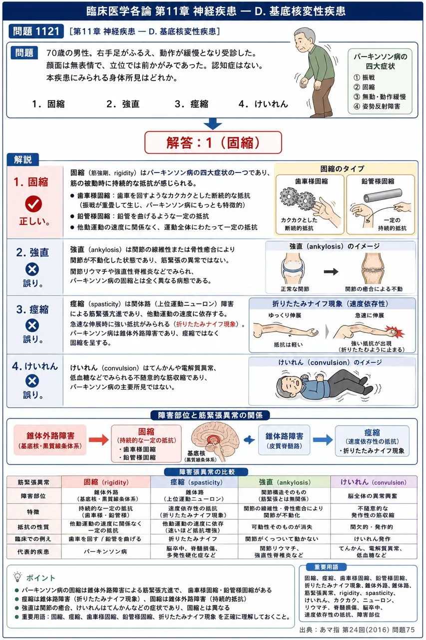 あマ指 第24回(2016) 問題75｜「70歳の男性。右手足がふるえ、動作が緩慢となり受診した。顔面は無表情で、立位では前かがみであった。認知症はない｡」本疾患にみられる身体所見はどれか。 解説図