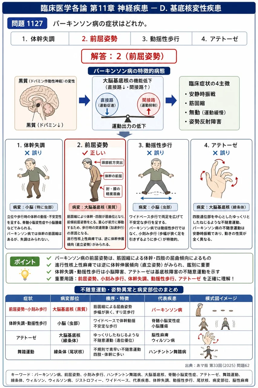 あマ指 第33回(2025) 問題62|パーキンソン病の症状はどれか。 解説図