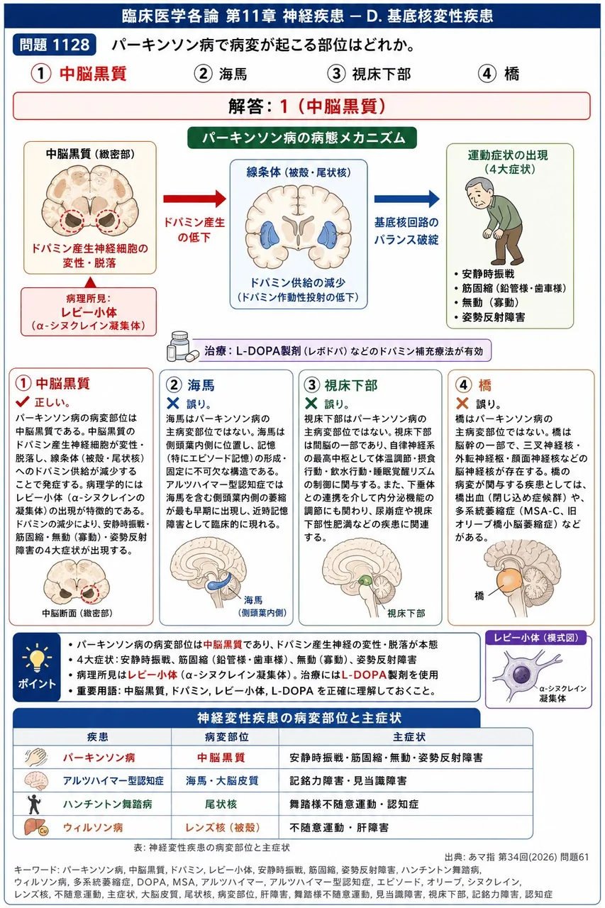あマ指 第34回(2026) 問題61｜パーキンソン病で病変が起こる部位はどれか。 解説図