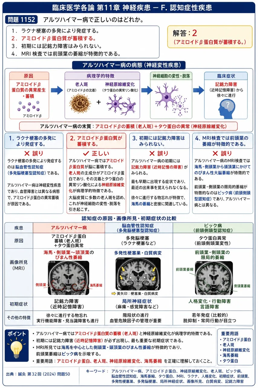 鍼灸 第32回(2024) 問題50｜アルツハイマー病で正しいのはどれか。 解説図