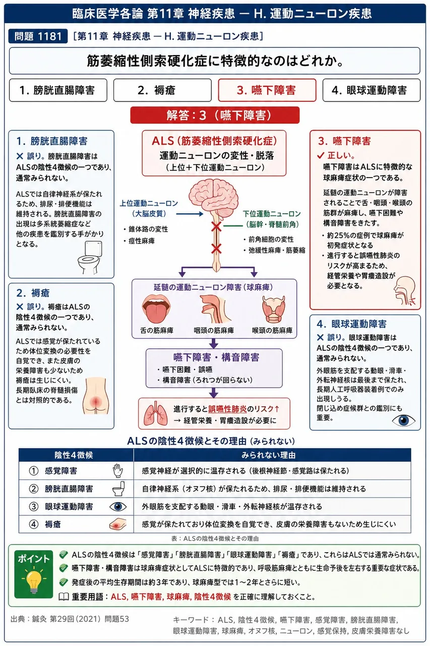 鍼灸 第29回(2021) 問題53｜筋萎縮性側索硬化症に特徴的なのはどれか。 解説図