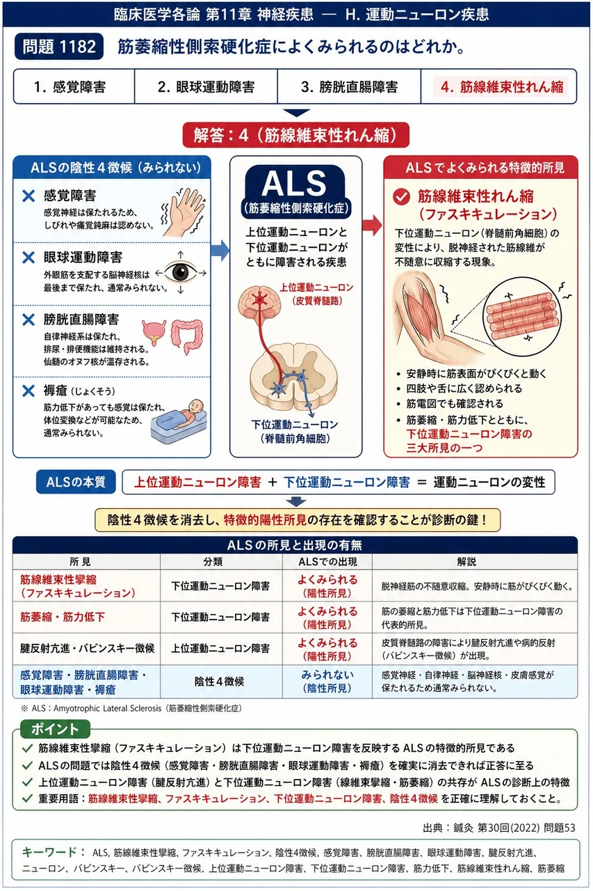 鍼灸 第30回(2022) 問題53｜筋萎縮性側索硬化症によくみられるのはどれか。 解説図