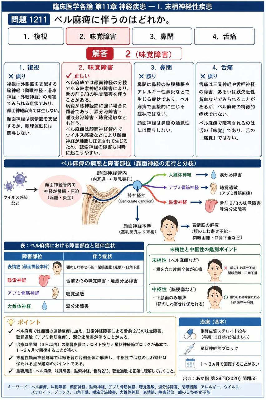 あマ指 第28回(2020) 問題55｜ベル麻痺に伴うのはどれか。 解説図