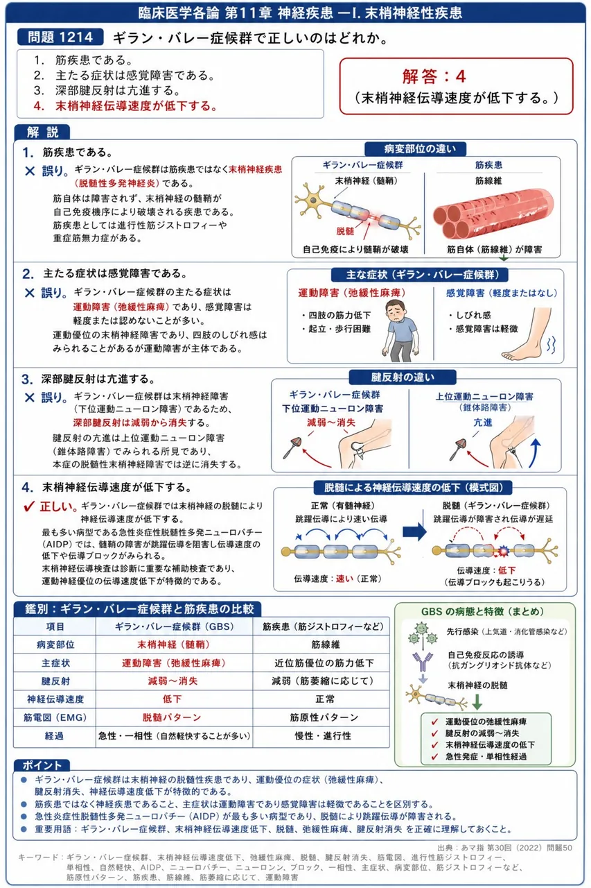 あマ指 第30回(2022) 問題50｜ギラン・バレー症候群で正しいのはどれか。 解説図