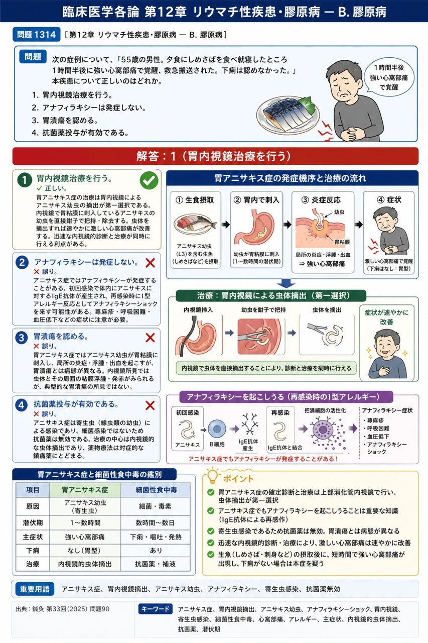 鍼灸 第33回(2025) 問題90｜次の症例について、「55歳の男性。夕食にしめさばを食べ就寝したところ1時間半後に強い心窩部痛で覚醒、救急搬送された。下痢は認めなかった。」本疾患について正しいのはどれか。 解説図