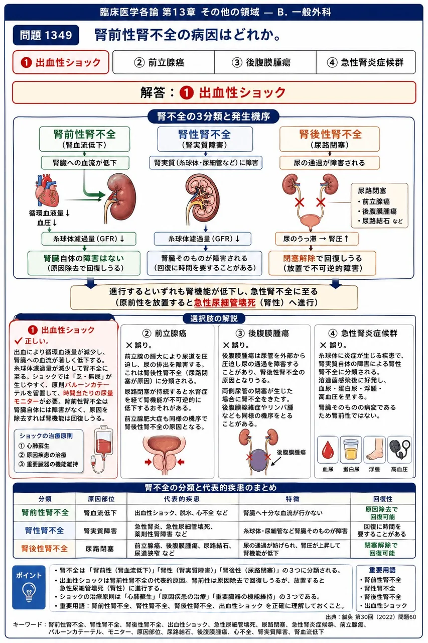 鍼灸 第30回(2022) 問題60｜腎前性腎不全の病因はどれか。 解説図
