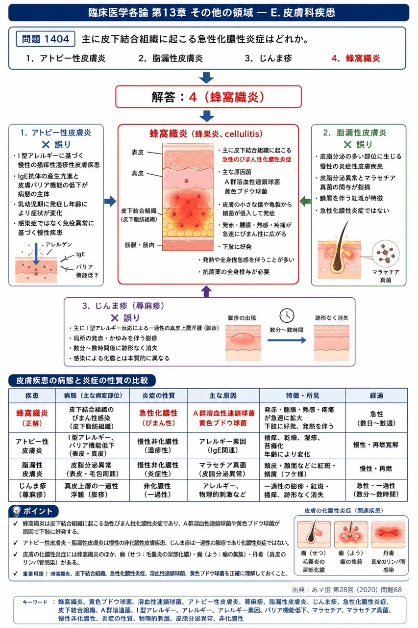 あマ指 第28回(2020) 問題68｜主に皮下結合組織に起こる急性化膿性炎症はどれか。 解説図