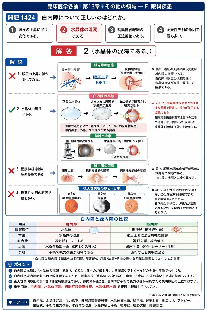 あマ指 第28回(2020) 問題65｜白内障について正しいのはどれか。 解説図