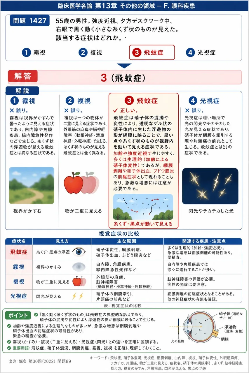 鍼灸 第30回(2022) 問題89｜「55歳の男性。強度近視。夕方デスクワーク中、右眼で黒く動く小さな糸くず状のものが見えた。」該当する症状はどれか。 解説図