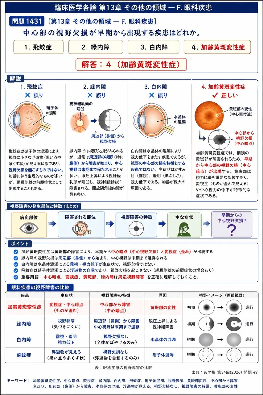 あマ指 第34回(2026) 問題49｜中心部の視野欠損が早期から出現する疾患はどれか。 解説図