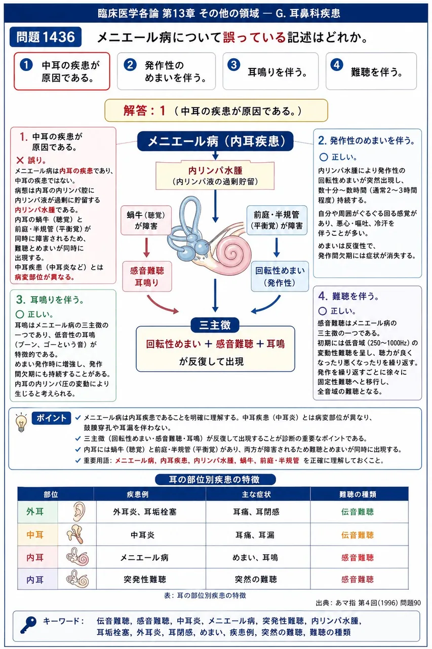 あマ指 第4回(1996) 問題90｜メニエール病について誤っている記述はどれか。 解説図