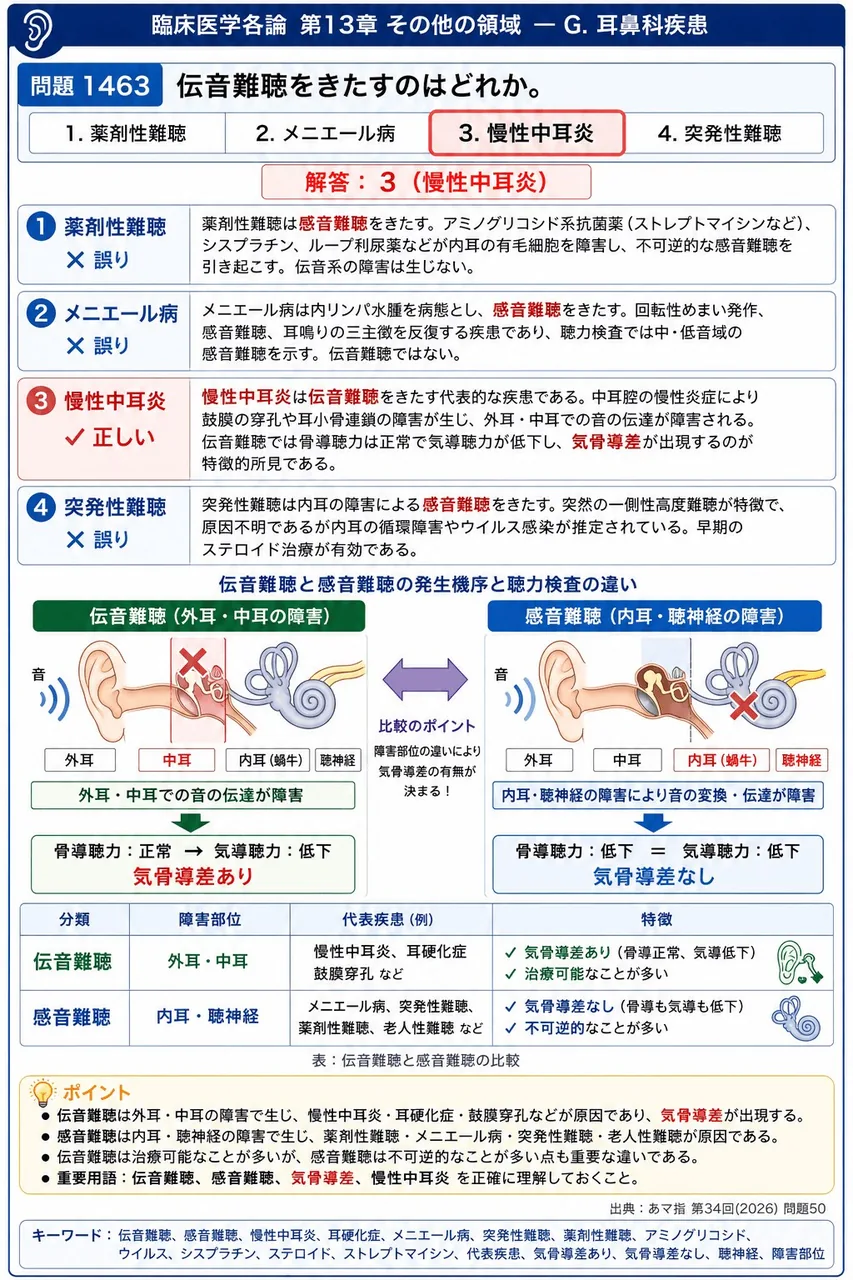 あマ指 第34回(2026) 問題50｜伝音難聴をきたすのはどれか。 解説図