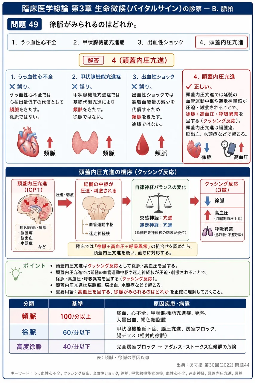 あマ指 第30回(2022) 問題44|徐脈がみられるのはどれか。 解説図