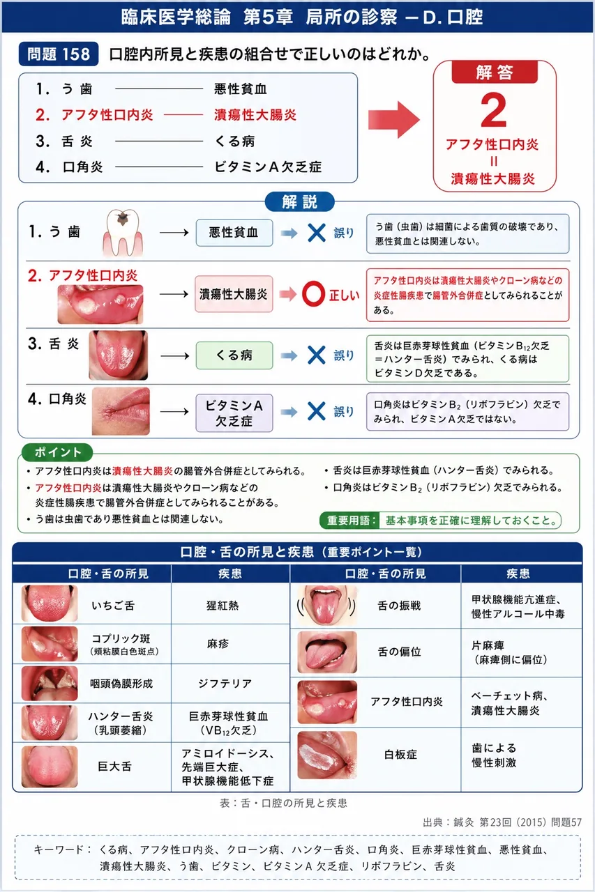 鍼灸 第23回(2015) 問題57|口腔内所見と疾患の組合せで正しいのはどれか。 解説図