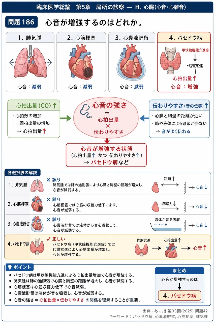 あマ指 第33回(2025) 問題42｜心音が増強するのはどれか。 解説図