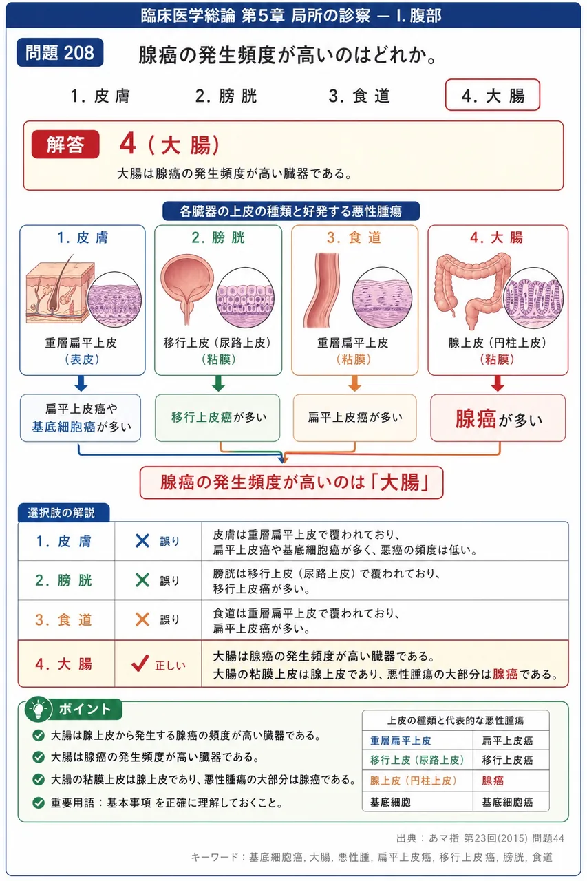 あマ指 第23回(2015) 問題44｜腺癌の発生頻度が高いのはどれか。 解説図
