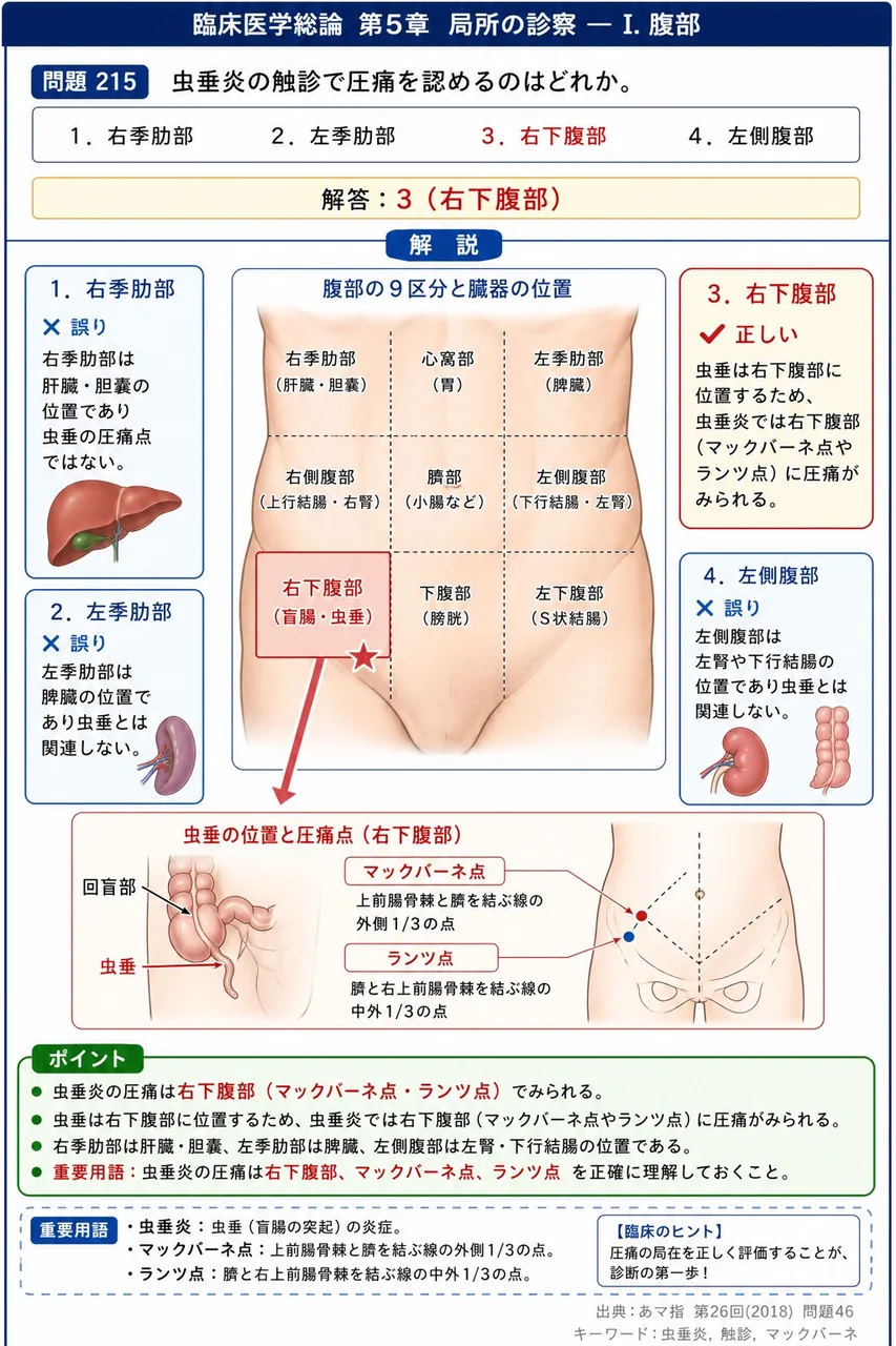 あマ指 第26回(2018) 問題46｜虫垂炎の触診で圧痛を認めるのはどれか。 解説図