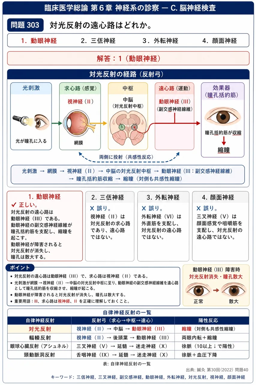 鍼灸 第30回(2022) 問題40|対光反射の遠心路はどれか。 解説図