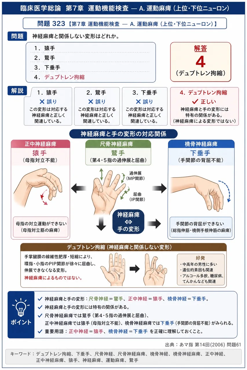 あマ指 第14回(2006) 問題61｜神経麻痺と関係しない変形はどれか。 解説図