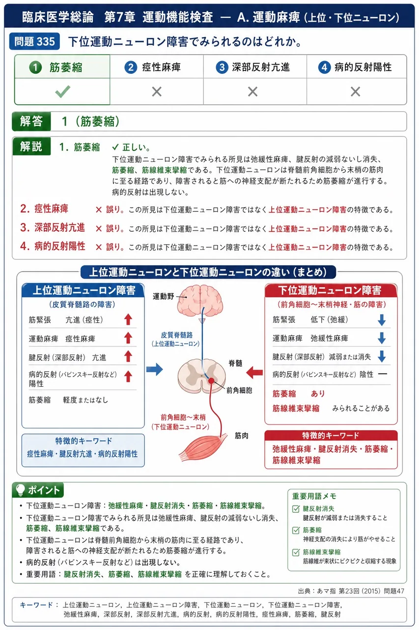 あマ指 第23回(2015) 問題47｜下位運動ニューロン障害でみられるのはどれか。 解説図