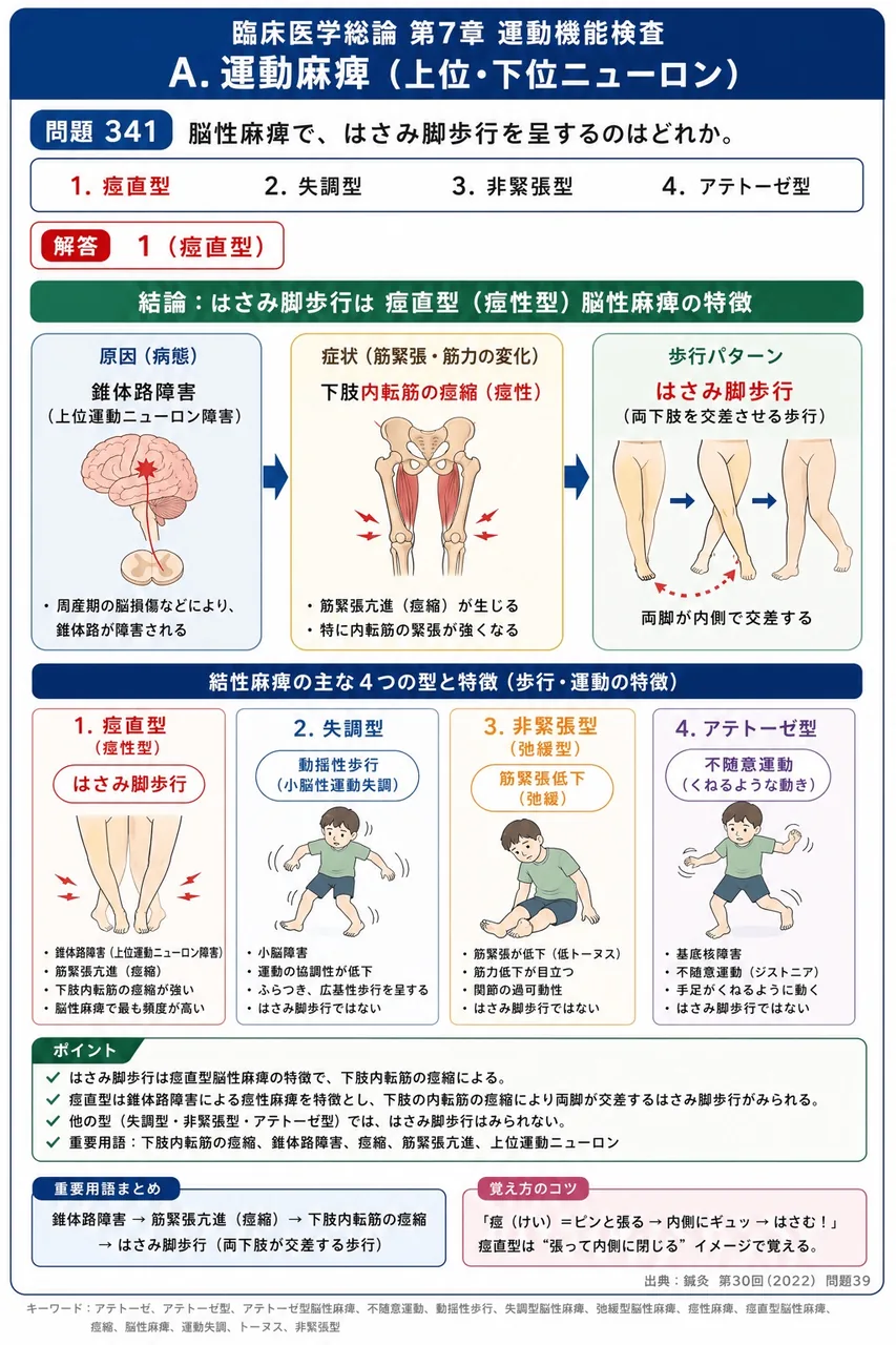 鍼灸 第30回(2022) 問題39｜脳性麻痺で、はさみ脚歩行を呈するのはどれか。 解説図