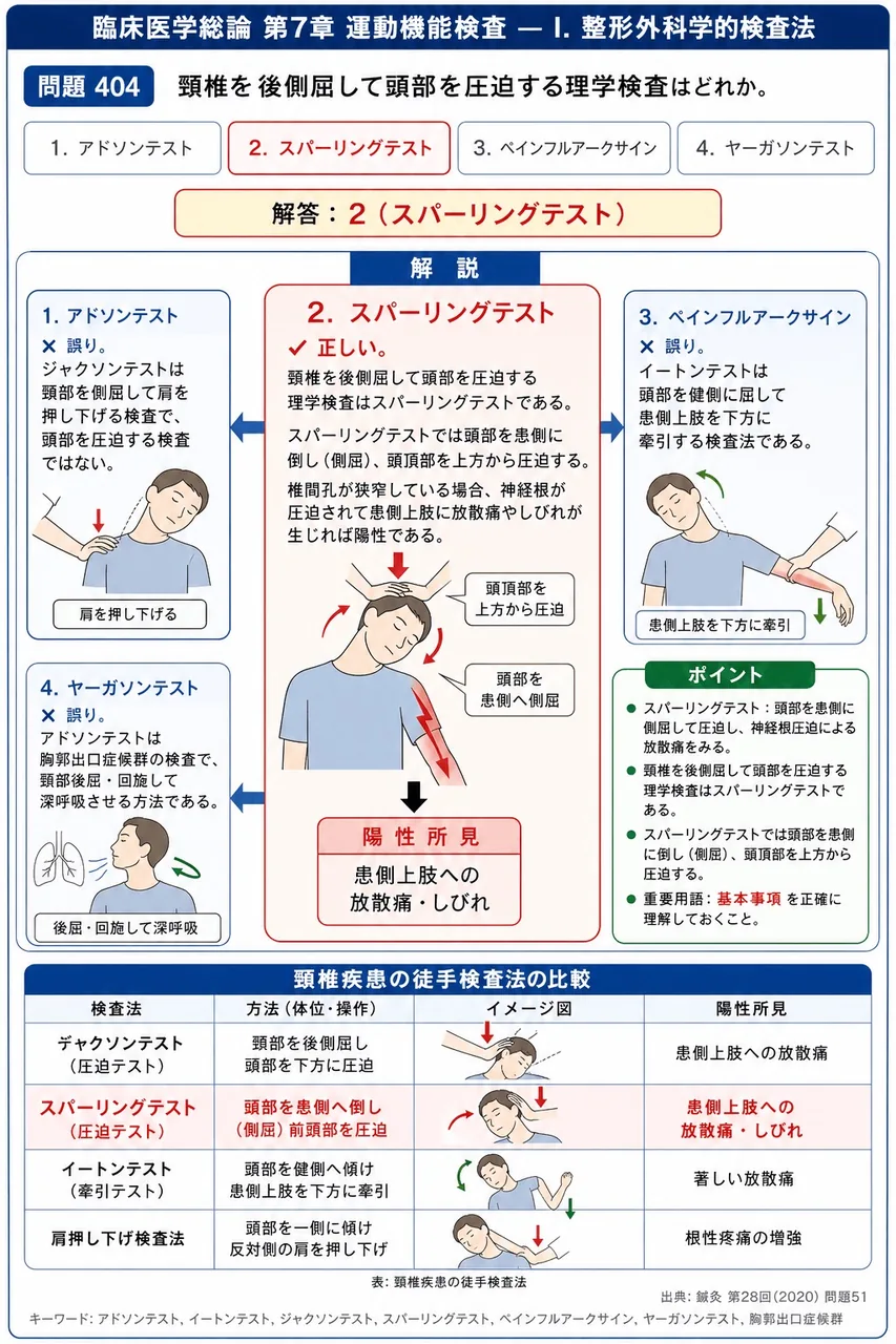 鍼灸 第28回(2020) 問題51｜頸椎を後側屈して頭部を圧迫する理学検査はどれか。 解説図
