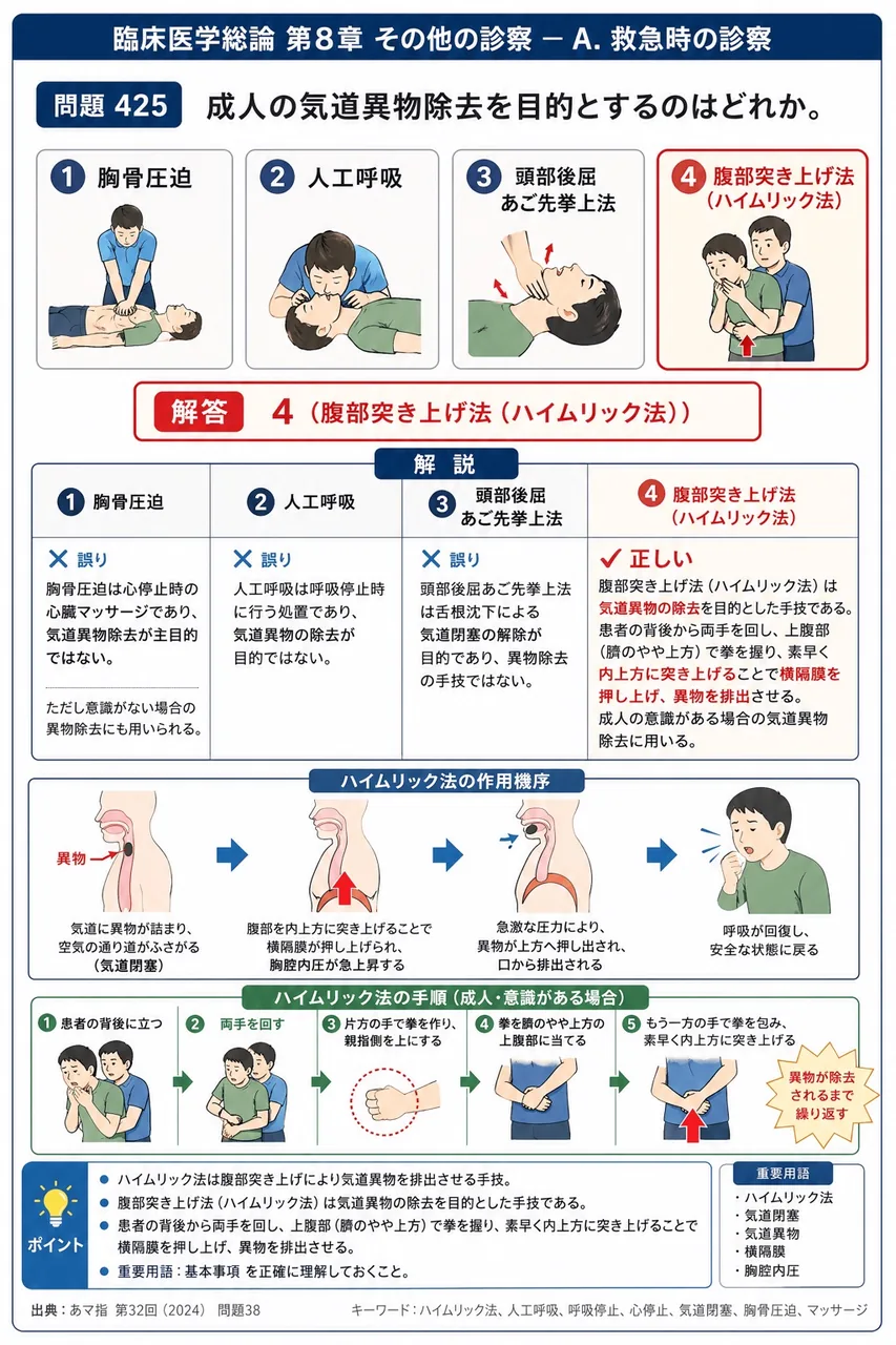 あマ指 第32回(2024) 問題38｜成人の気道異物除去を目的とするのはどれか。 解説図
