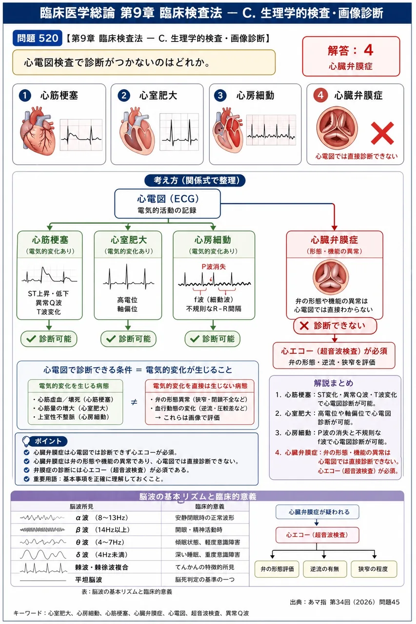あマ指 第34回(2026) 問題45｜心電図検査で診断がつかないのはどれか。 解説図