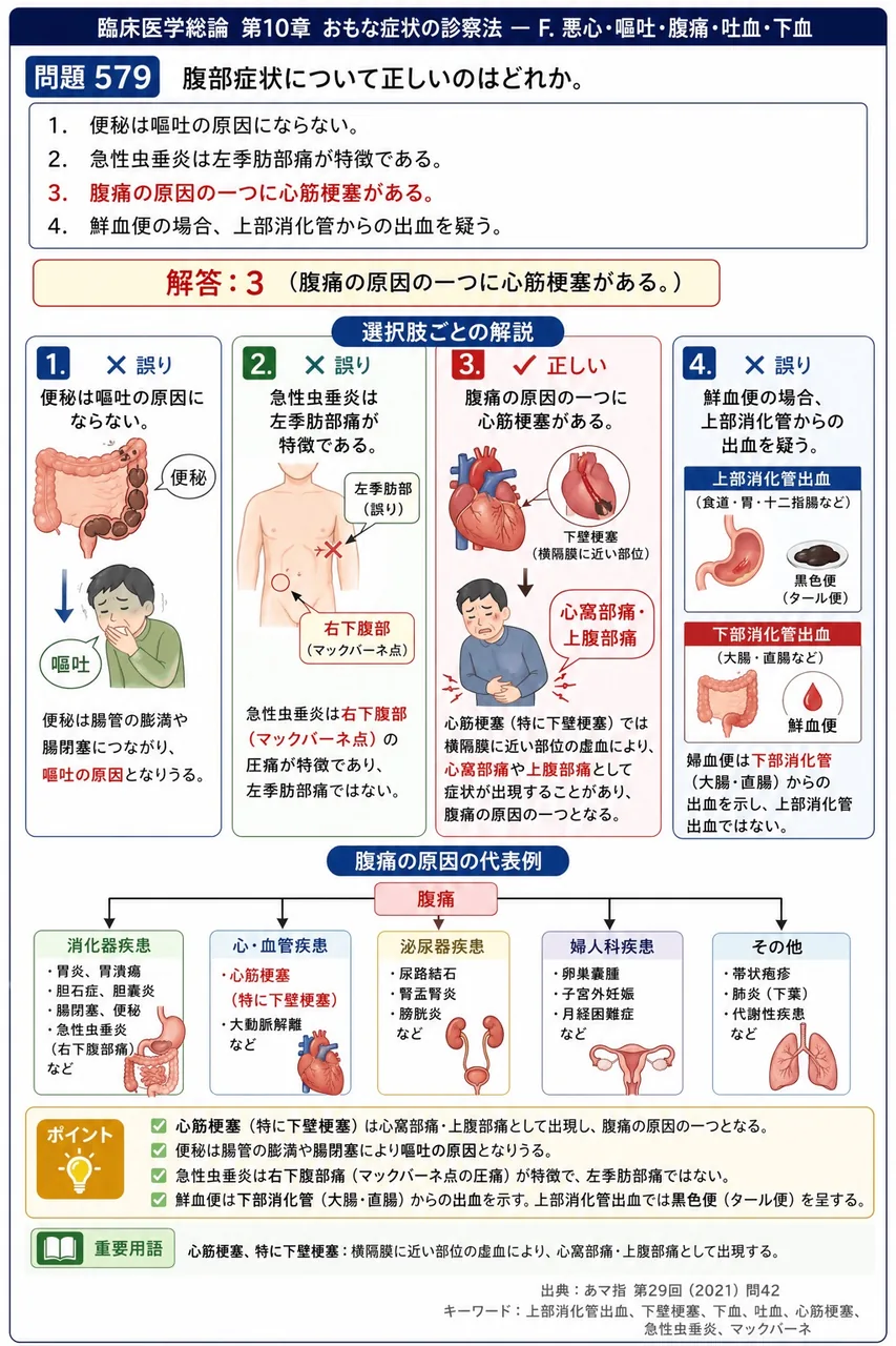 あマ指 第29回(2021) 問題42｜腹部症状について正しいのはどれか。 解説図