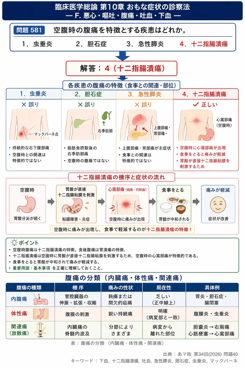 あマ指 第34回(2026) 問題40｜空腹時の腹痛を特徴とする疾患はどれか。 解説図