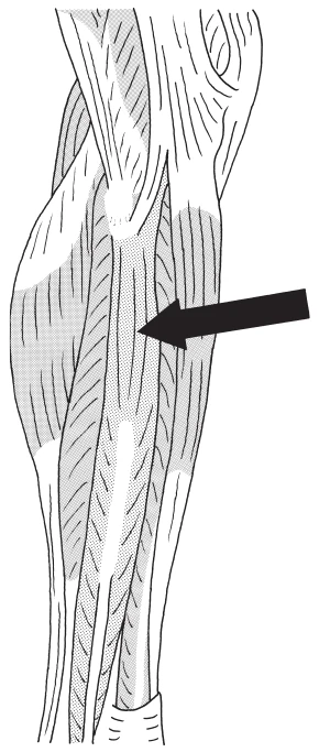 図