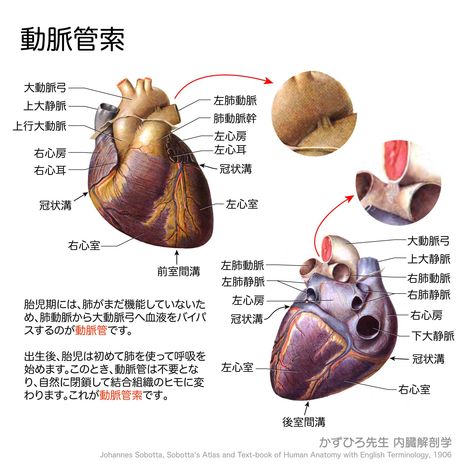 動脈管索