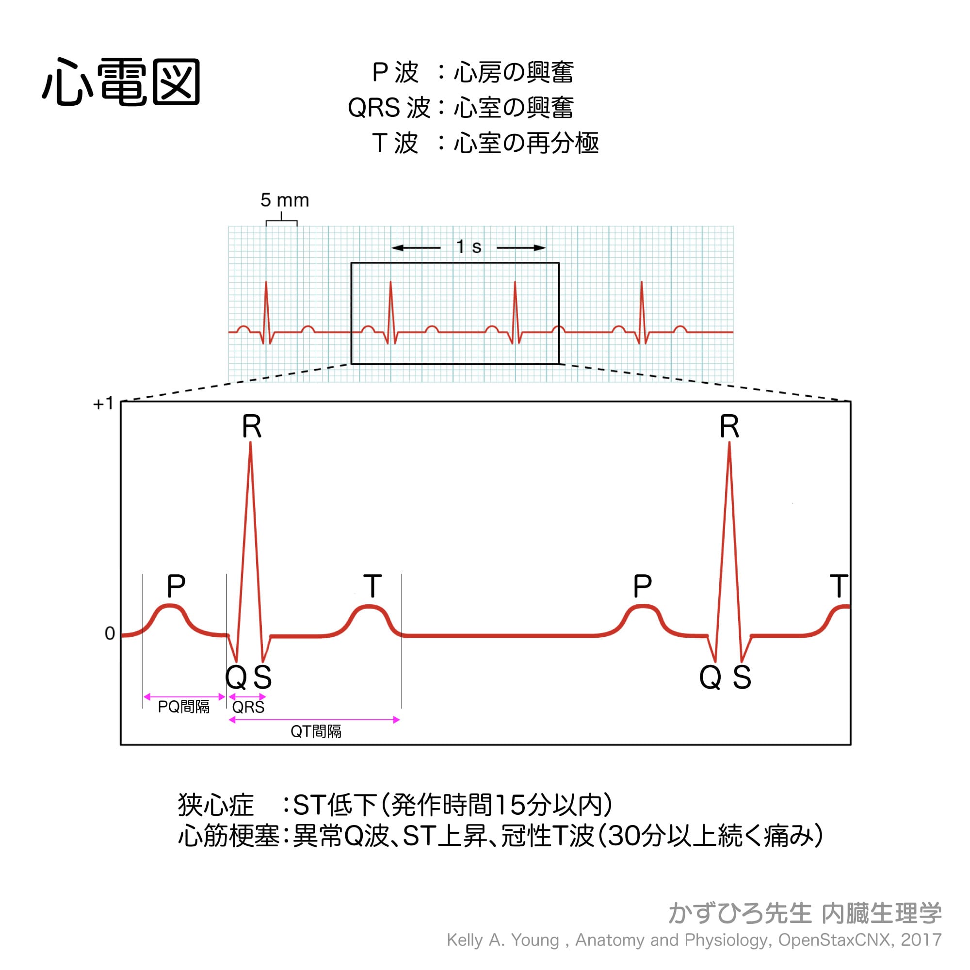 心電図